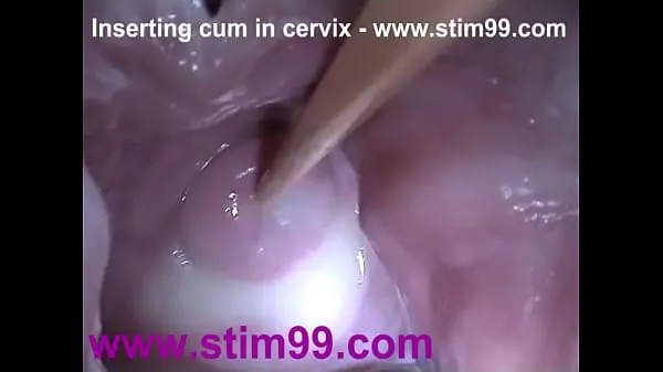 HD Insertion Semen Cum in Cervix Wide Stretching Pussy Speculum drive Clips